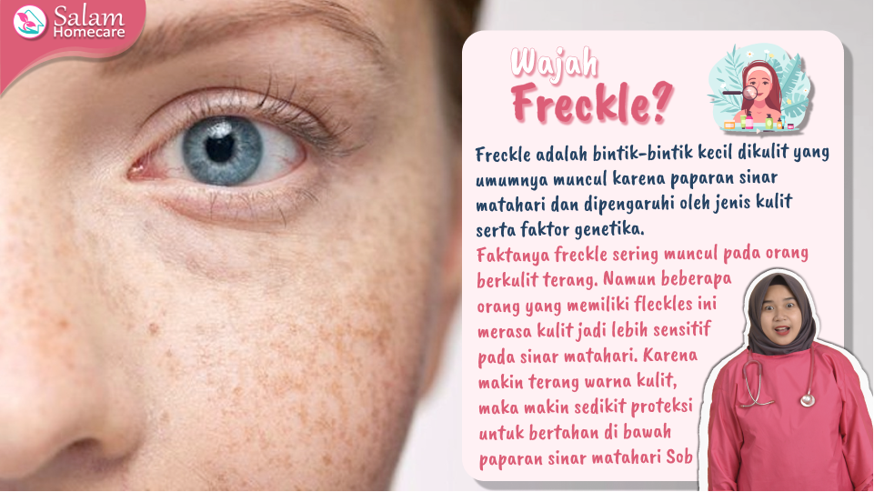 Freckle : Fakta dan Gejalanya
