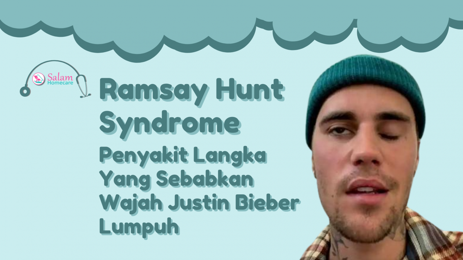 Ramsay Hunt Syndrome, Penyakit Langka Yang Sebabkan Wajah Justin Bieber Lumpuh