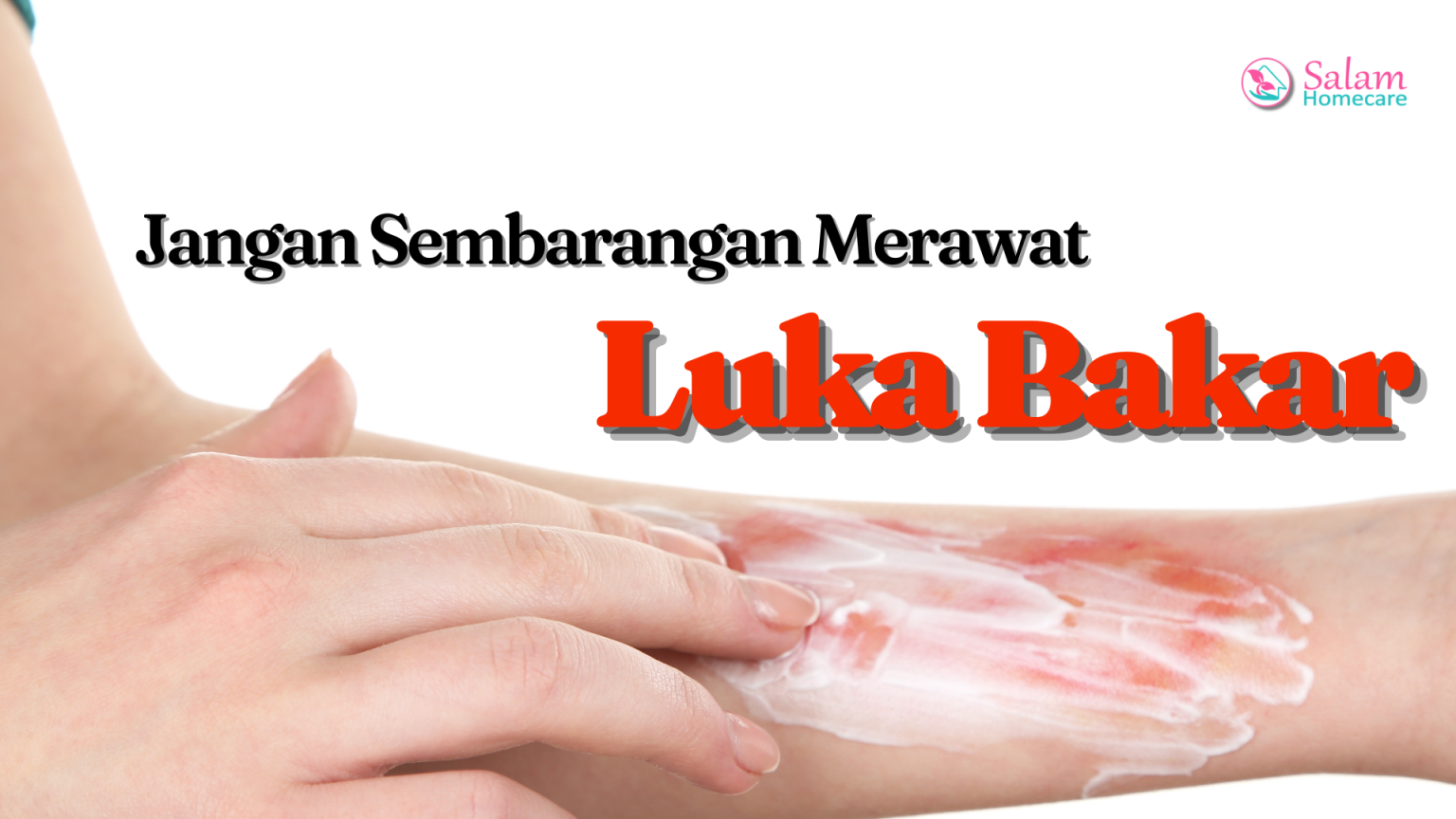 Perawatan Luka Bakar Begini Caranya Salam Homecare