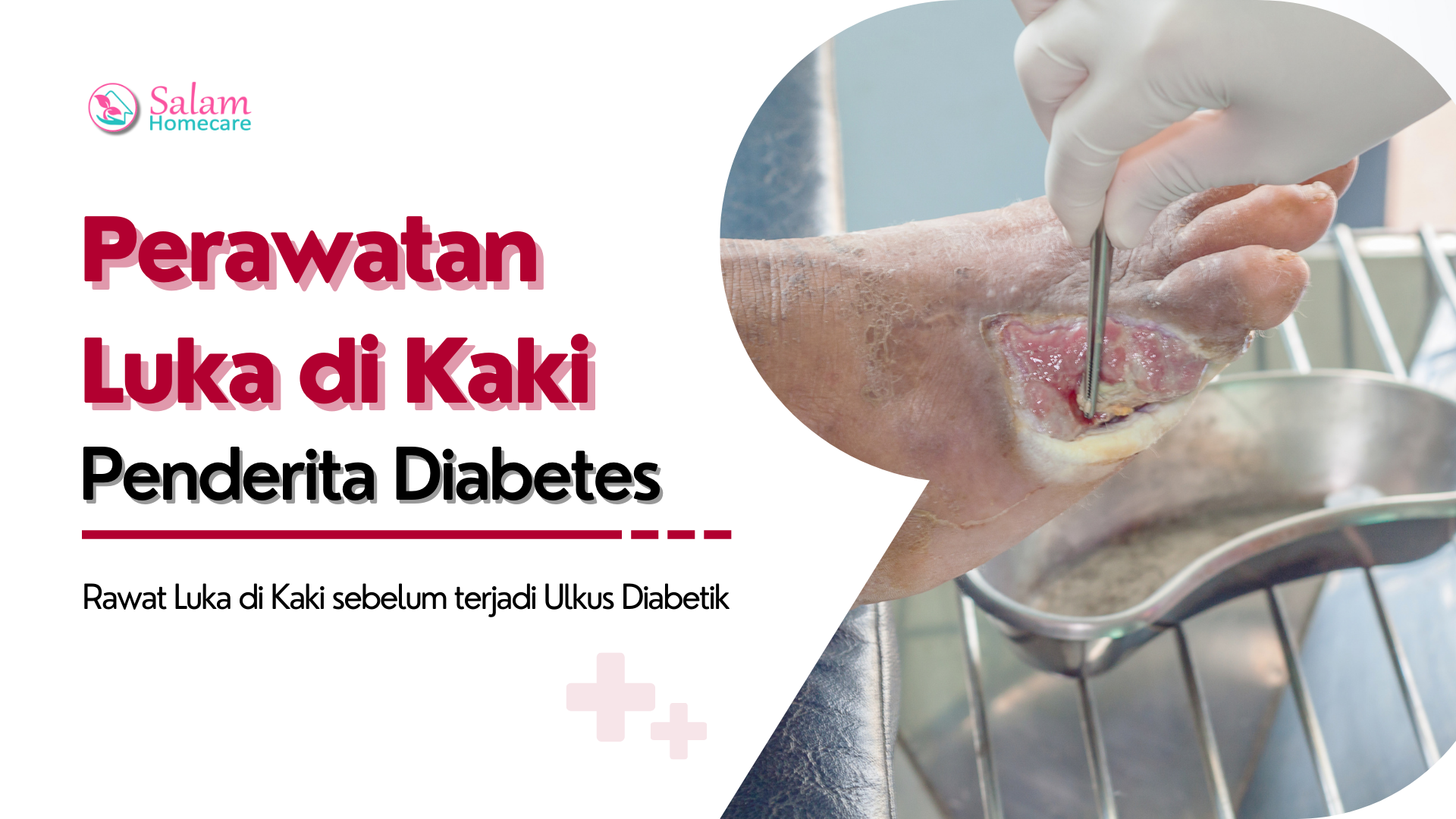 Perawatan Luka Di Kaki Pengidap Diabetes Salam Homecare 