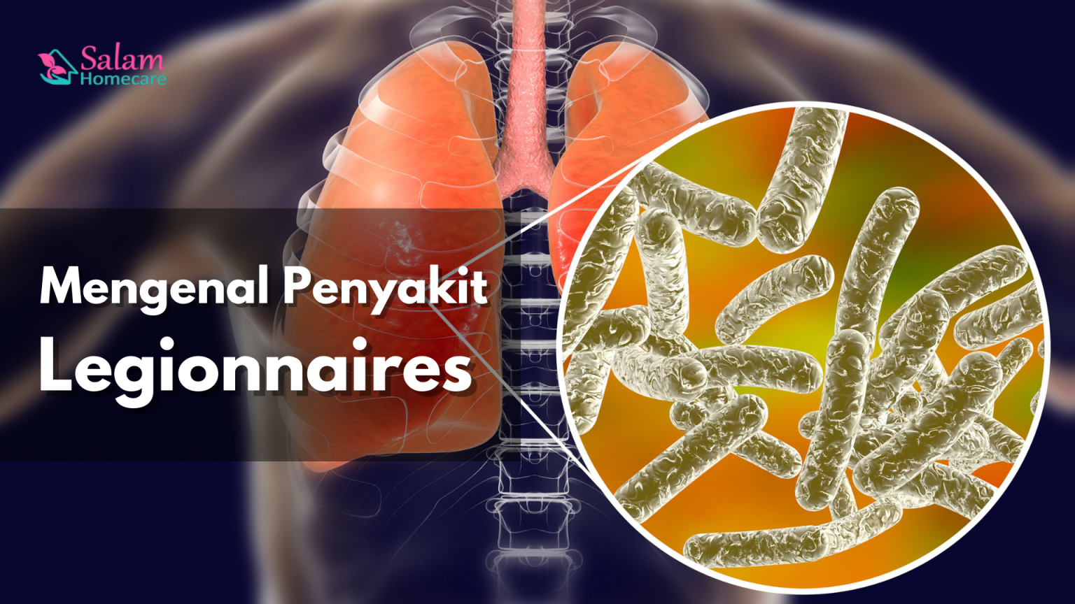 Mengenal Penyakit Legionnaires - Salam Homecare
