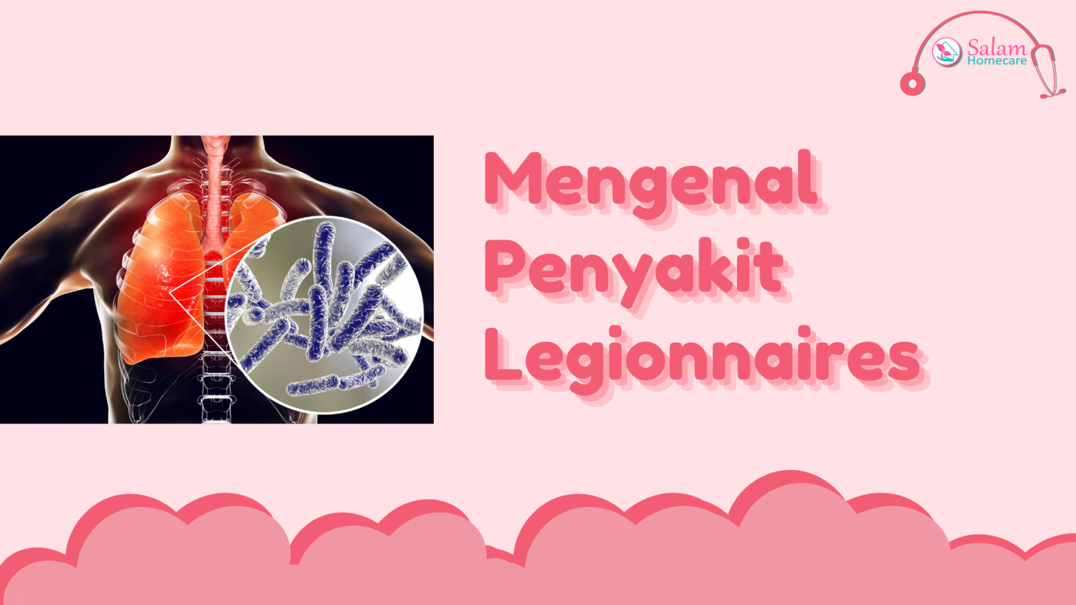 Mengenal Penyakit Legionnaires
