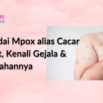 Waspadai Mpox alias Cacar Monyet, Kenali Gejala dan Pencegahannya