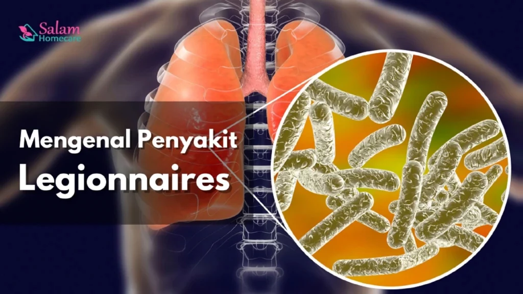 Apa Itu Penyakit Legionnaires