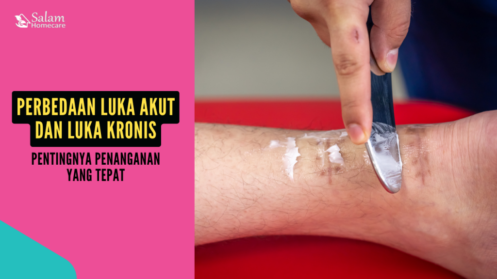 Perbedaan Luka Akut dan Luka Kronis: Pentingnya Penanganan yang Tepat