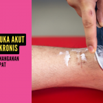 Perbedaan Luka Akut dan Luka Kronis: Pentingnya Penanganan yang Tepat
